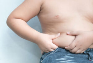 Bambini obesi e fegato grasso