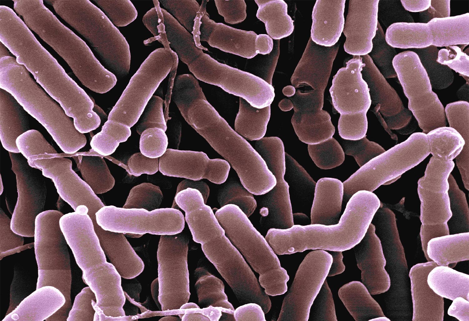 Bifidobacterium longum